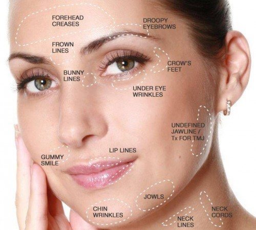 Anti-Wrinkle - 3 Areas - Facethetics
